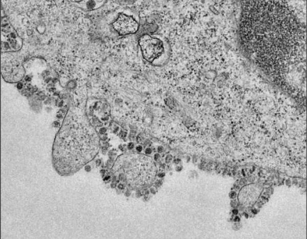 الصورة الأولى لتكاثر خلايا فيروس كورونا القاتل