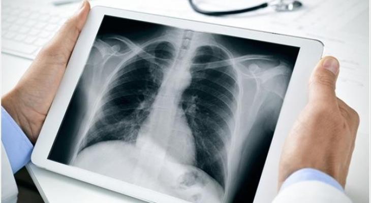 علماء: تمارين التنفس تُساعد على التخلص من تلف الرئة 