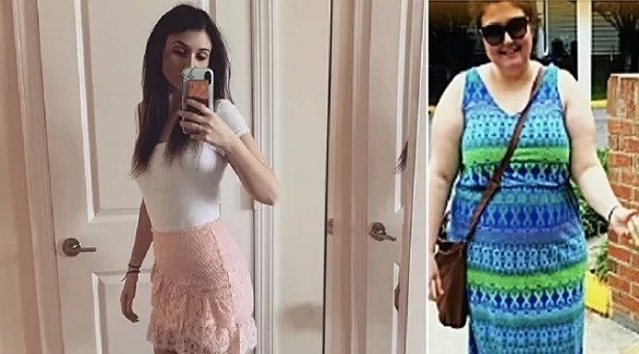 شابة تخسر 50 كلغ من وزنها وتُصبح عارضة أزياء في أمريكا 