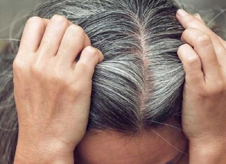دراسة تكشف أسباب تحول الشعر إلى اللون الرمادي