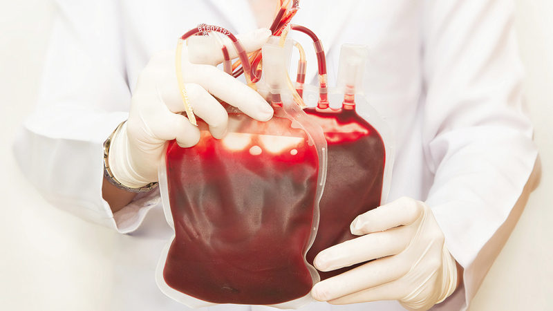 نقل صفائح دم مغسولة لإنقاذ حياة مريض