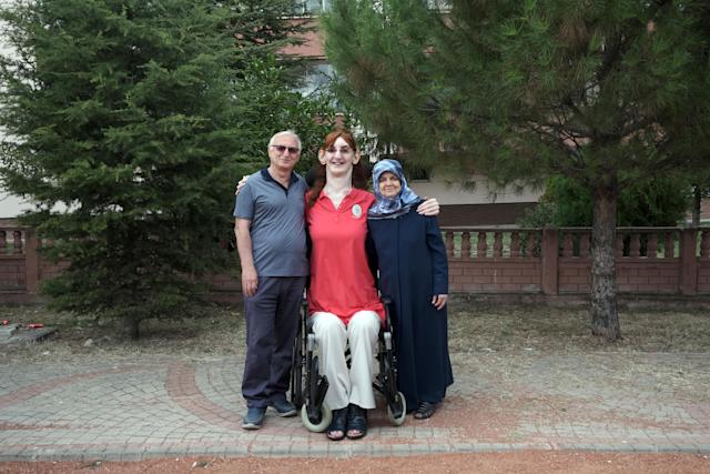 "215,16 سم"  الشابة التركية رُمَيْسة جيلجي أطول امرأة بالعالم