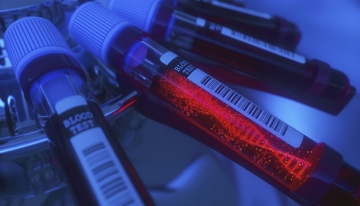 هل يصبح فحص الدم كافياً لرصد السرطان؟